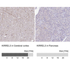 Anti-KIRREL3 Antibody