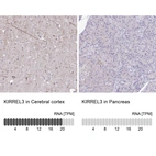 Anti-KIRREL3 Antibody