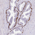 Anti-LRRC26 Antibody