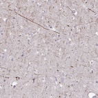 Immunohistochemical staining of human cerebral cortex shows high expression.
