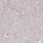 Immunohistochemical staining of human cerebral cortex shows high expression.