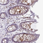Immunohistochemical staining of human colon shows strong cytoplasmic positivity in glandular cells.