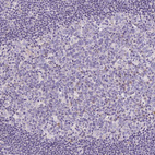 Anti-LRRC26 Antibody