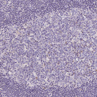 Immunohistochemical staining of human lymph node shows no positivity in germinal center cells as expected.