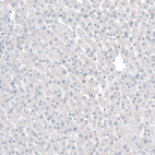 Immunohistochemical staining of human liver shows no positivity in hepatocytes as expected.