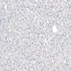 Immunohistochemical staining of human liver shows no positivity in hepatocytes as expected.