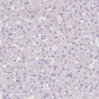 Immunohistochemical staining of human liver shows no positivity in hepatocytes as expected.
