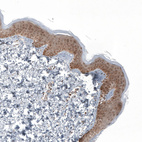 Anti-KLHL24 Antibody