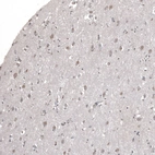 Immunohistochemical staining of human Cerebral cortex shows moderate cytoplasmic positivity in neuronal cells.