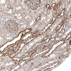 Immunohistochemical staining of human Kidney shows moderate cytoplasmic positivity in cells in tubules.