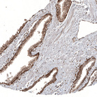 Anti-KLHL24 Antibody