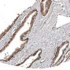 Immunohistochemical staining of human Prostate shows moderate cytoplasmic positivity in glandular cells.