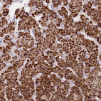 Anti-CYP11B1 Antibody