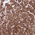 Anti-CYP11B1 Antibody