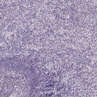 Anti-CYP11B1 Antibody