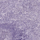 Immunohistochemical staining of human tonsil shows no positivity in non-germinal center cells as expected.
