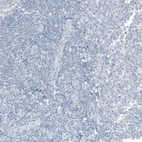 Immunohistochemical staining of human tonsil shows no positivity in non-germinal center cells as expected.