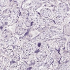 Immunohistochemical staining of human placenta shows no positivity in trophoblastic cells as expected.