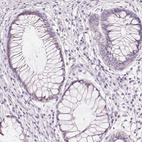 Anti-CYP11B1 Antibody