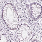 Immunohistochemical staining of human rectum shows no positivity in glandular cells as expected.