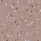 Anti-FBXL16 Antibody