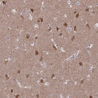 Anti-FBXL16 Antibody