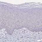 Immunohistochemical staining of human skin shows no positivity in squamous epithelial cells as expected.