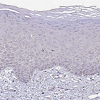 Immunohistochemical staining of human skin shows no positivity in squamous epithelial cells as expected.