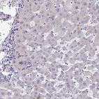 Anti-FBXL16 Antibody