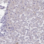 Immunohistochemical staining of human liver shows no positivity in hepatocytes as expected.
