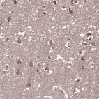 Immunohistochemical staining of human cerebral cortex shows moderate cytoplasmic positivity in neurons.