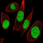 Anti-GTF2E1 Antibody