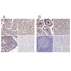 Immunohistochemical staining of human gastrointestinal, liver, lymph node and skeletal muscle using Anti-FUCA1 antibody HPA056371 (A) shows similar protein distribution across tissues to independent antibody HPA046542 (B).