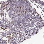 Immunohistochemical staining of human lymph node shows strong granular cytoplasmic positivity in germinal center cells.