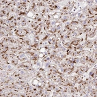 Immunohistochemical staining of human liver shows strong granular cytoplasmic positivity in hepatocytes.
