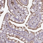 Immunohistochemical staining of human small intestine shows strong granular cytoplasmic positivity in glandular cells.