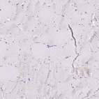 Immunohistochemical staining of human skeletal muscle shows no positivity in myocytes as expected.