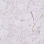 Immunohistochemical staining of human skeletal muscle shows no positivity in myocytes as expected.