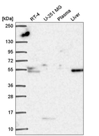 Western blot analysis in human cell line RT-4, human cell line U-251 MG, human plasma and human liver tissue.
