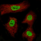 Anti-CDX2 Antibody