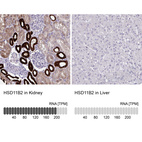 Anti-HSD11B2 Antibody