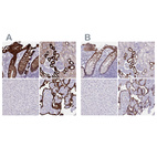 Immunohistochemistry analysis in human kidney and liver tissues using HPA056385 antibody. Corresponding HSD11B2 RNA-seq data are presented for the same tissues.