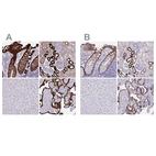 Immunohistochemical staining of human gastrointestinal, kidney, liver and placenta using Anti-HSD11B2 antibody HPA056385 (A) shows similar protein distribution across tissues to independent antibody HPA042186 (B).