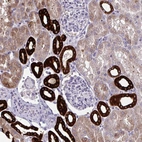 Immunohistochemical staining of human kidney shows strong cytoplasmic positivity in cells in tubules.