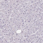 Anti-HSD11B2 Antibody