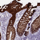 Immunohistochemical staining of human kidney shows high expression.