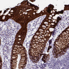 Anti-HSD11B2 Antibody