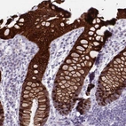 Immunohistochemical staining of human rectum shows strong cytoplasmic positivity in glandular cells.