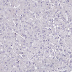 Immunohistochemical staining of human liver shows low expression as expected.