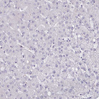 Anti-HSD11B2 Antibody